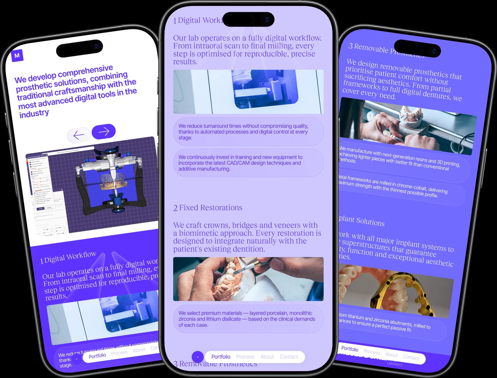 Mendoza Dental across three mobile screens showing hero, digital workflow, and removable prosthetics