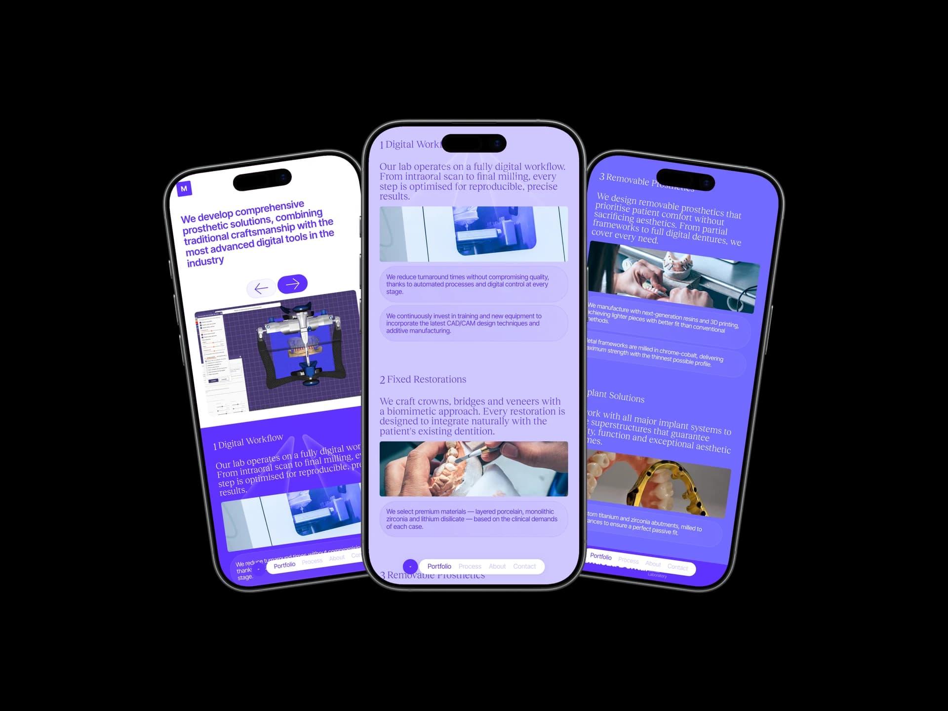 Mendoza Dental website displayed on three iPhones