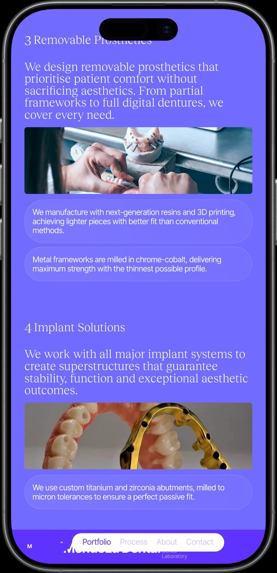 Mendoza Dental removable prosthetics and implant solutions on mobile