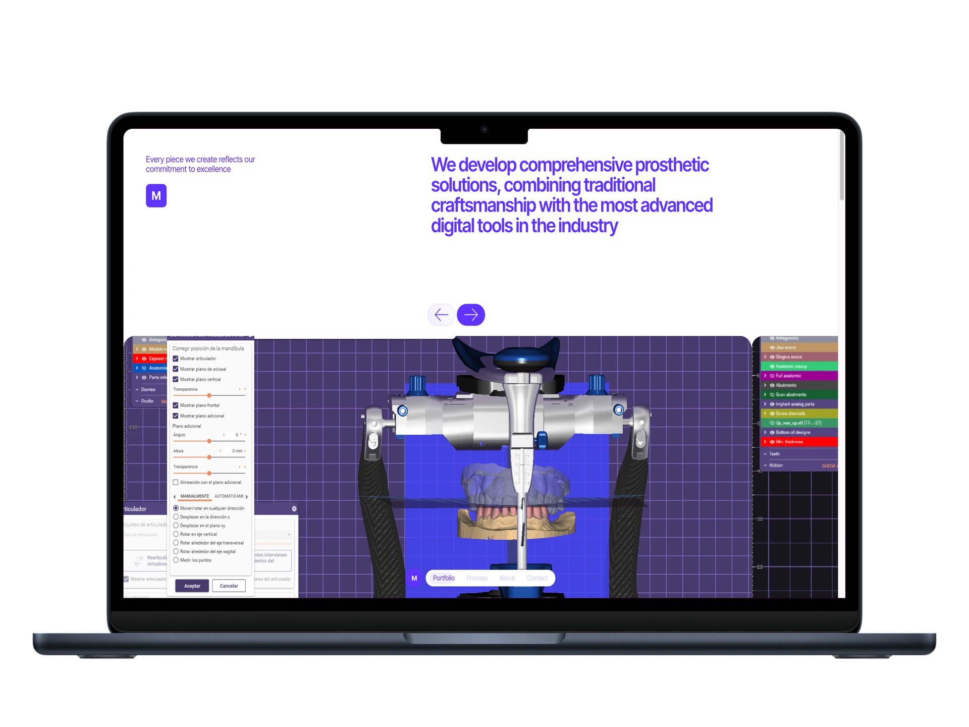 Mendoza Dental Laboratory homepage on desktop showing prosthetic equipment on purple grid background