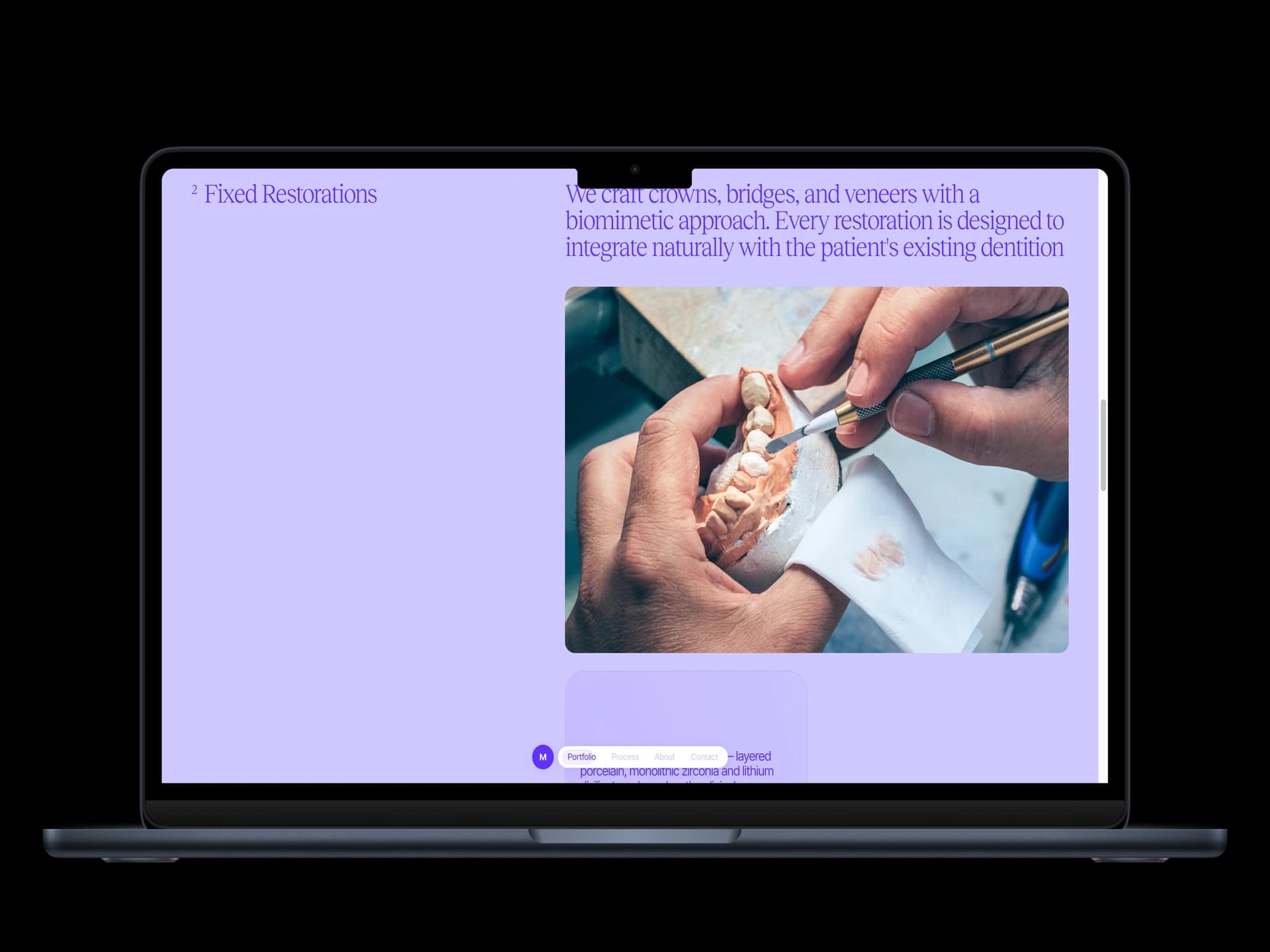 Mendoza Dental Fixed Restorations section with hand-crafted porcelain photography