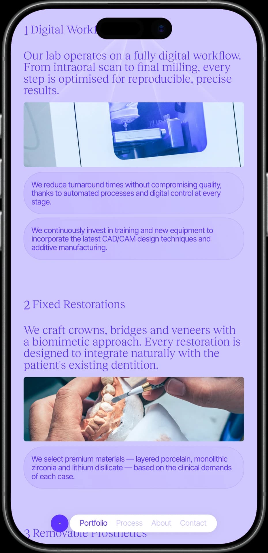 Mendoza Dental digital workflow section on mobile